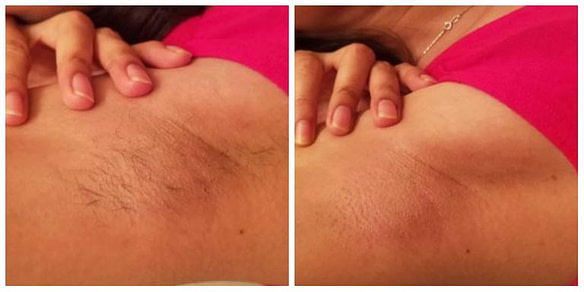 silk-epil5 braun epilator